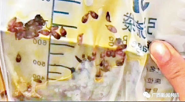 中華肝吸蟲會潛伏在人類體內。