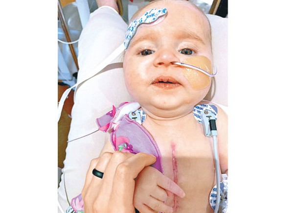 出生時諾瓦克患有先天性心臟缺損。