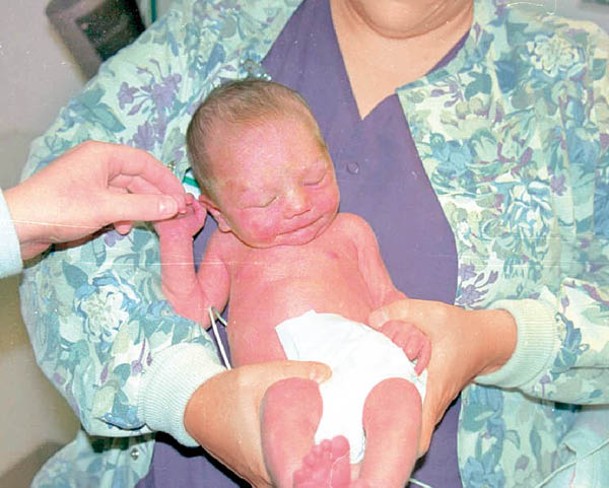 海蓋迪什─斯圖爾特嬰兒時幸運得到救助。