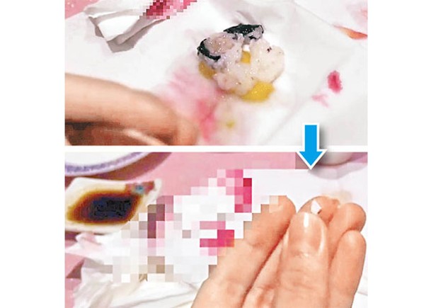 一名女子在壽司店用餐期間吃到瓷片。