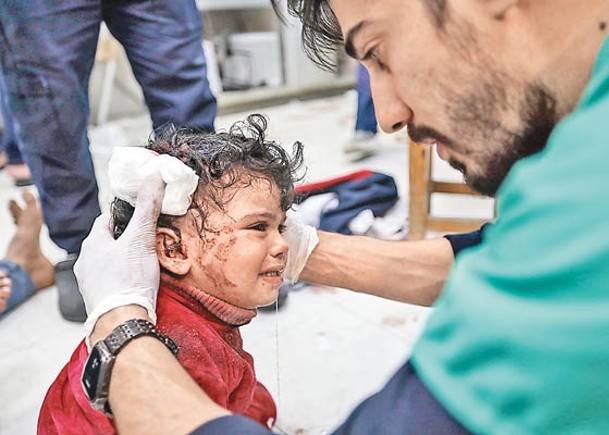 以色列與哈馬斯開戰後大批兒童受傷。（Getty Images圖片）