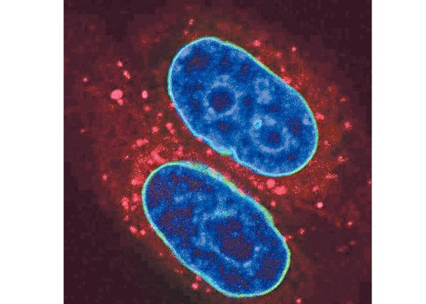 溶小體（紅色）在噬核時，會攻擊癌細胞核中的DNA（藍色）和核膜（綠色）。