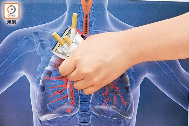吸煙是冠心病的一個主要成因，煙民應立即戒掉。