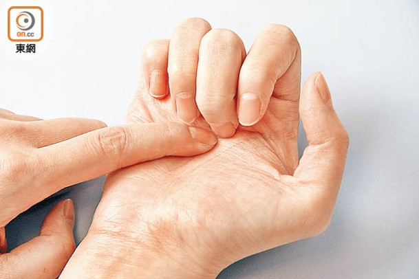 勞宮穴於手掌心，屈指握拳時中指尖對應的位置即是。