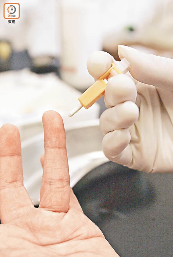 政府亦正研究不同「篤手指」驗抗體的試劑。