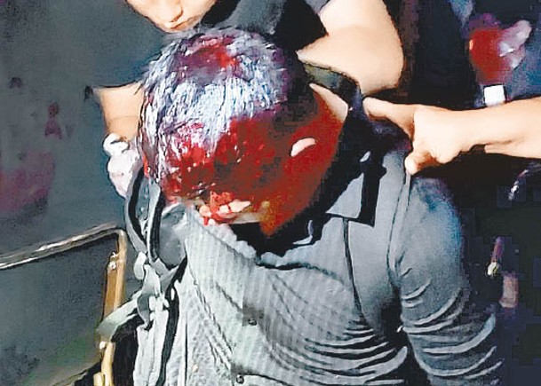 其中一名疑犯與警員糾纏間頭部受傷流血。