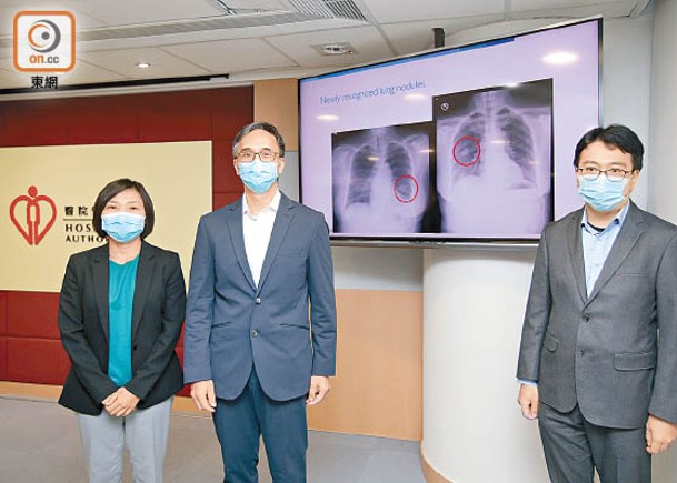 AI系統幫助病人提早識別肺部病變。左起：彭育華、王耀忠及雷俊達。（袁志豪攝）