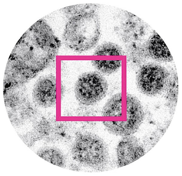 香港大學醫學院發布Omicron變種病毒在顯微鏡下的面貌。（港大提供）