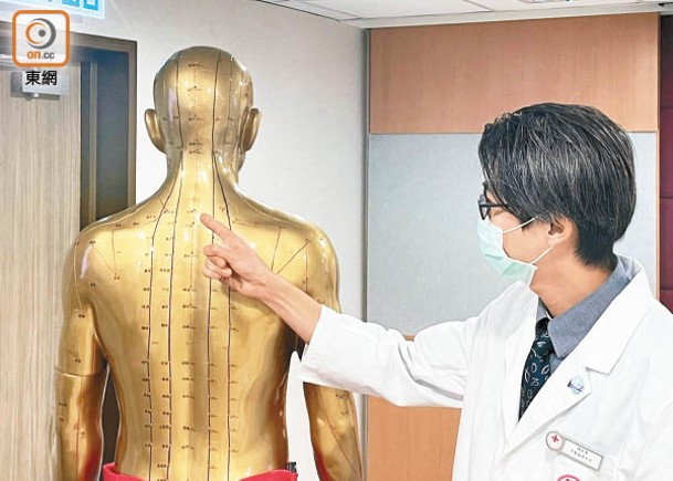 中醫服務主任陳啓賢示範為患者作天灸，因應患者病情在相應穴位敷貼中藥。（莊得盈攝）