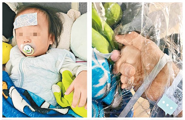 北大嶼山醫院：16個月大男嬰疑染疫苦等超過10小時仍未獲安排入院。
