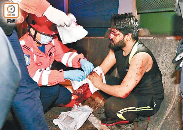 一名南亞裔跟車工人受傷淌血。