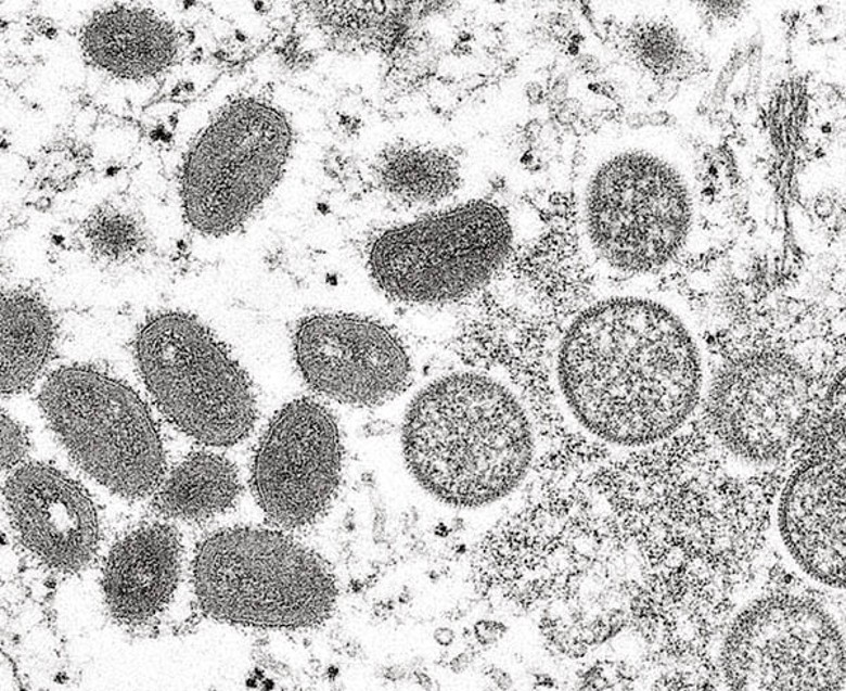 猴痘病毒依賴體液接觸，或長期面對面接觸引致的飛沫傳播。