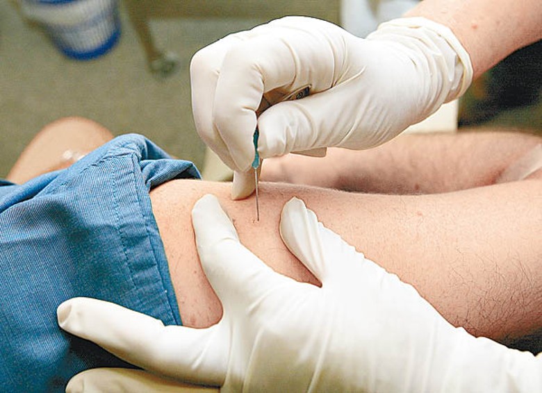 用作治療天花的牛痘疫苗有助抑制猴痘病毒。