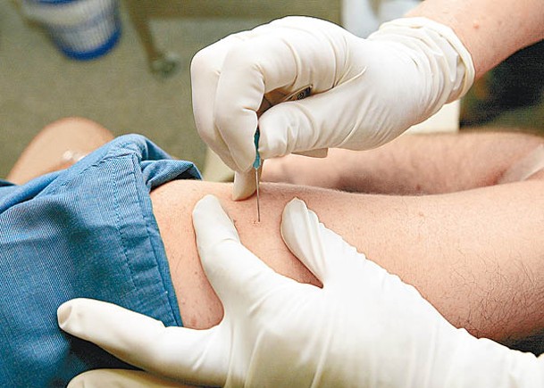 用作治療天花的牛痘疫苗有助抑制猴痘病毒。