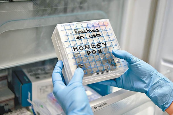 西班牙有猴痘爆發，實驗室化驗猴痘樣本。