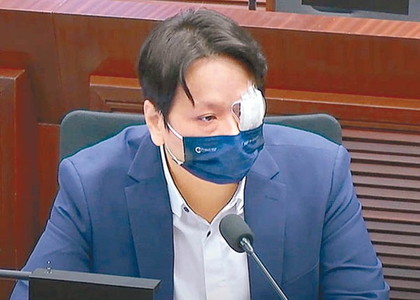 鄧家彪左眼蓋紗布出席會議。