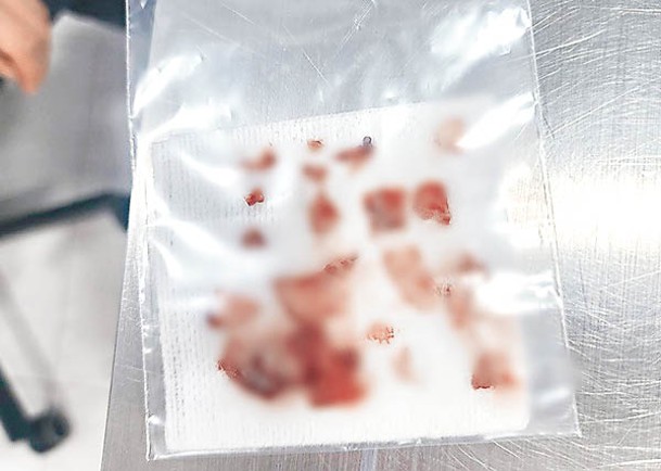 獸醫施手術在狗狗顱內取出18塊碎片。