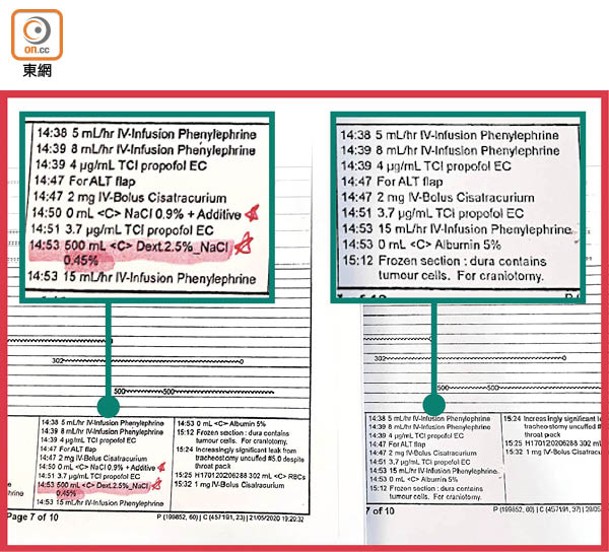 原有的輸液紀錄（左）遭到刪除。