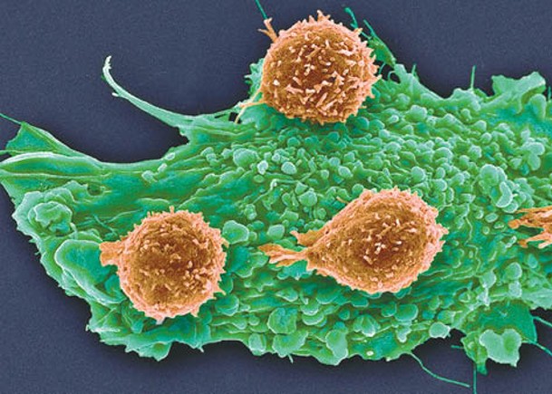 中大觀察纖維母細胞聚集  揭原花青素C1可抗癌