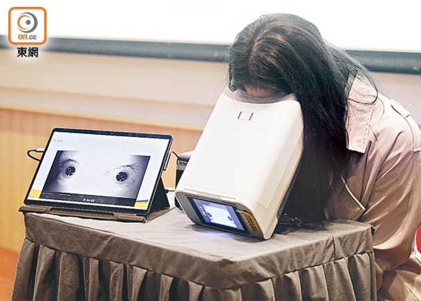 有大學研發人工智能便攜式眼底相機。