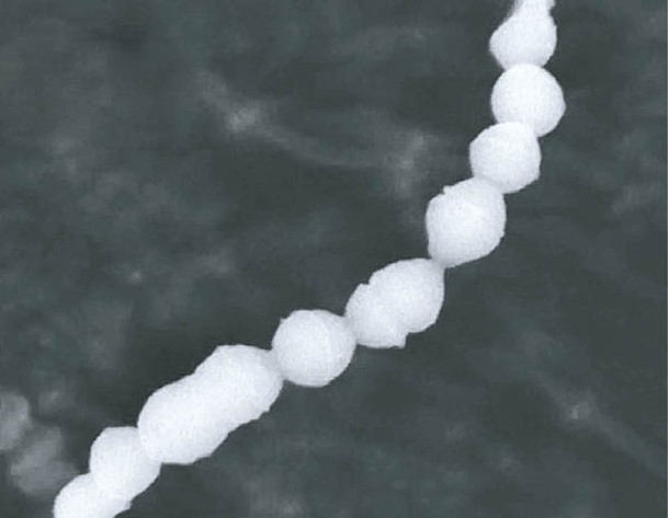 甲型鏈球菌可透過飛沫或呼吸道分泌物傳播。