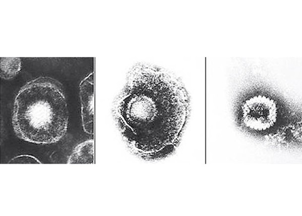 B病毒又俗稱猴疱疹，受感染可能影響中樞神經系統或脊椎神經。