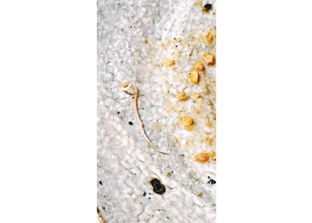 鮟鱇魚肝有一條長約3至4厘米的寄生蟲。