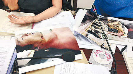 馬躍的母親孟朝紅展示證據照片，可明顯見到馬躍下頜部有一處傷口。（中新社圖片）