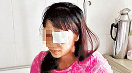 被挖去左眼的李女士目前正留院治療。（互聯網圖片）