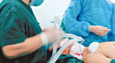 李姓醫生被割喉後接受手術搶救。（互聯網圖片)