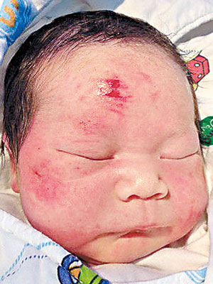 幸存男嬰頭部擦傷。（互聯網圖片）