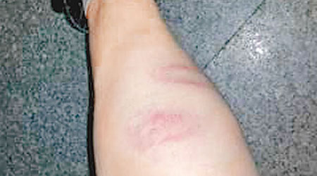 女法官腳上有被毆傷痕。（互聯網圖片）