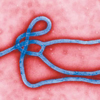 伊波拉病毒。（互聯網圖片）