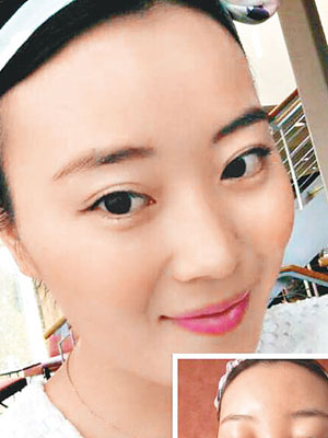 劉女士上載照片表示用面膜後過敏臉腫。（互聯網圖片）