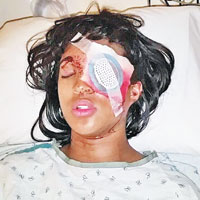 康納被警員所發射的豆袋彈間接導致左眼失明。（互聯網圖片）