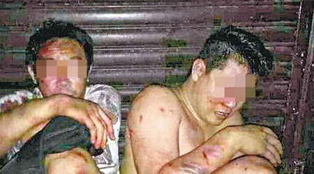 網傳兩名疑犯被打至傷痕纍纍的照片。（互聯網圖片）