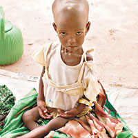 非洲兒童飽受饑荒煎熬。（互聯網圖片）