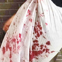 有學員在網上展示血漬斑斑的枕頭。