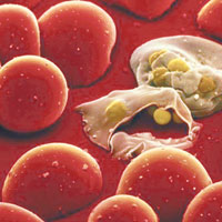 薩蘭蒂稱瘧原蟲身藏的蛋白質，能治療九成類別的癌症。（互聯網圖片）