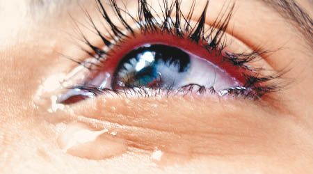 儀器能有效改善乾眼症患者的淚水分泌問題。（互聯網圖片）