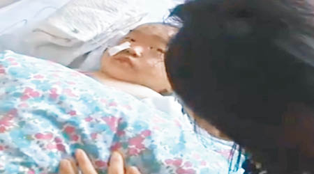黑龍江慶安一名兩歲女童意外跌進自家經營麻辣燙店的湯鍋中，全身五成半皮膚燙傷，送院時一度休克，持續高燒不退，至今仍未度過危險期。