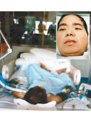 崔飛（小圖）生前因肝衰竭在醫院接受治療。（互聯網圖片）