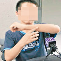 逃走少年受訪講述慘況。（馬來西亞《光華日報》圖片）