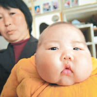 國產奶粉屢被檢出含有毒物質，不少嬰兒因此慘成「大頭BB」。