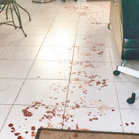 傷者逃入髮廊，地上留下大灘血漬。（互聯網圖片）