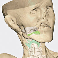 科學家重塑奧茨的聲帶、喉嚨和口腔。（互聯網圖片）