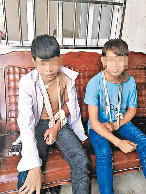 兩名少年遭敲斷鎖骨強迫犯案。（互聯網圖片）