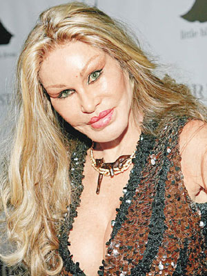 維爾登施泰因（Jocelyn Wildenstein）