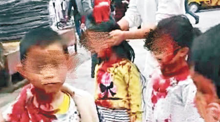 網傳照片可見多名幼童遭斬傷，血流披面。（互聯網圖片）