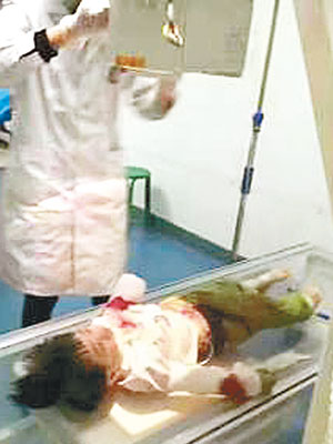 小蓉蓉被送院救治。（互聯網圖片）